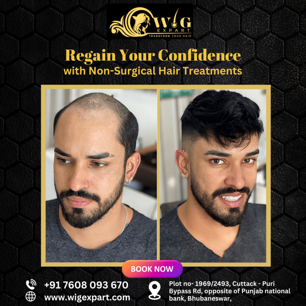 Non surgical hair treatment