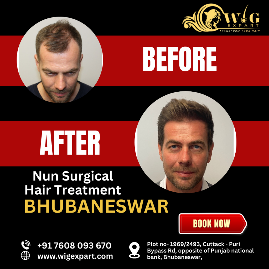 nun sergical hair treatment in bbsr