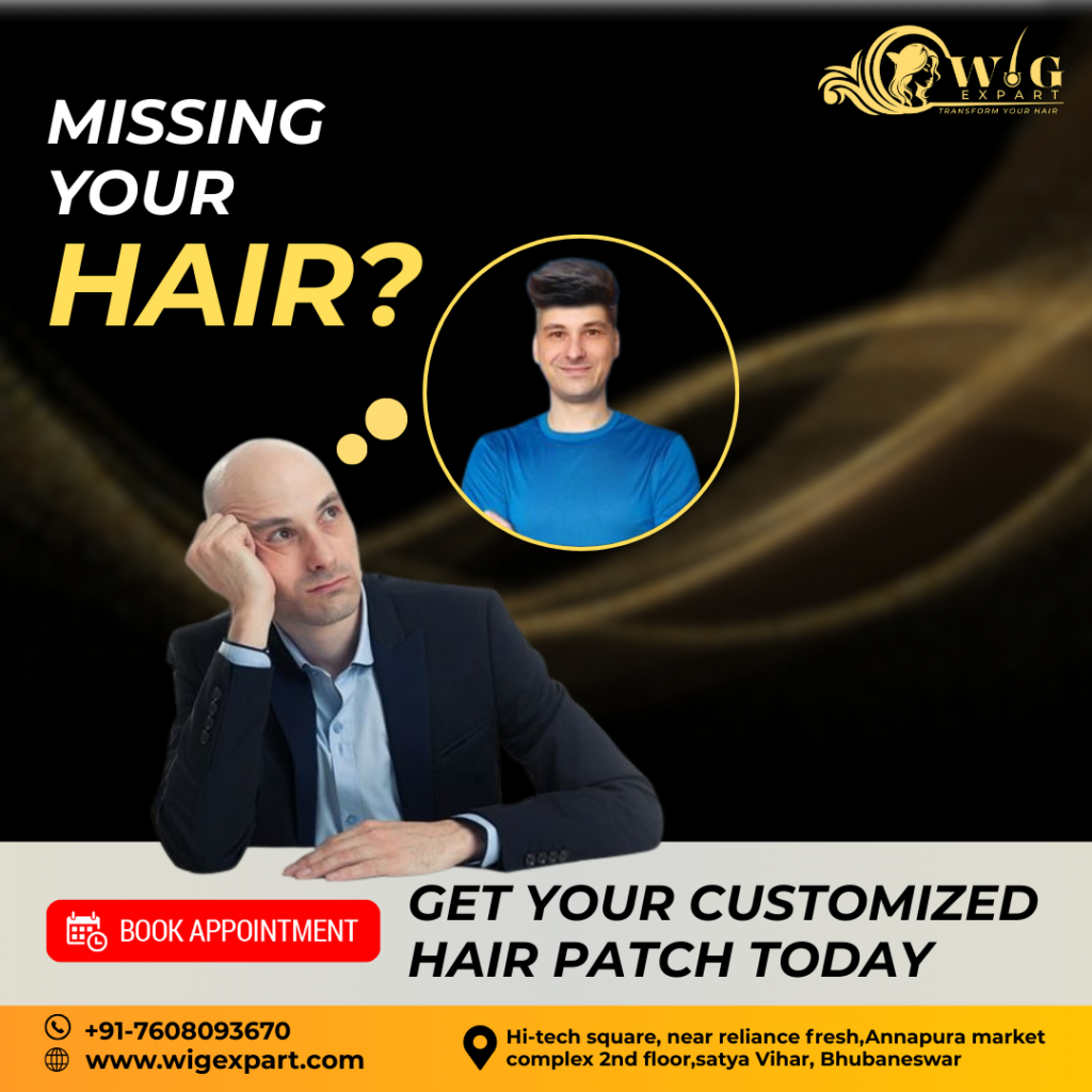 GET YOUR CUSTOMIZED HAIR PATCH TODAY