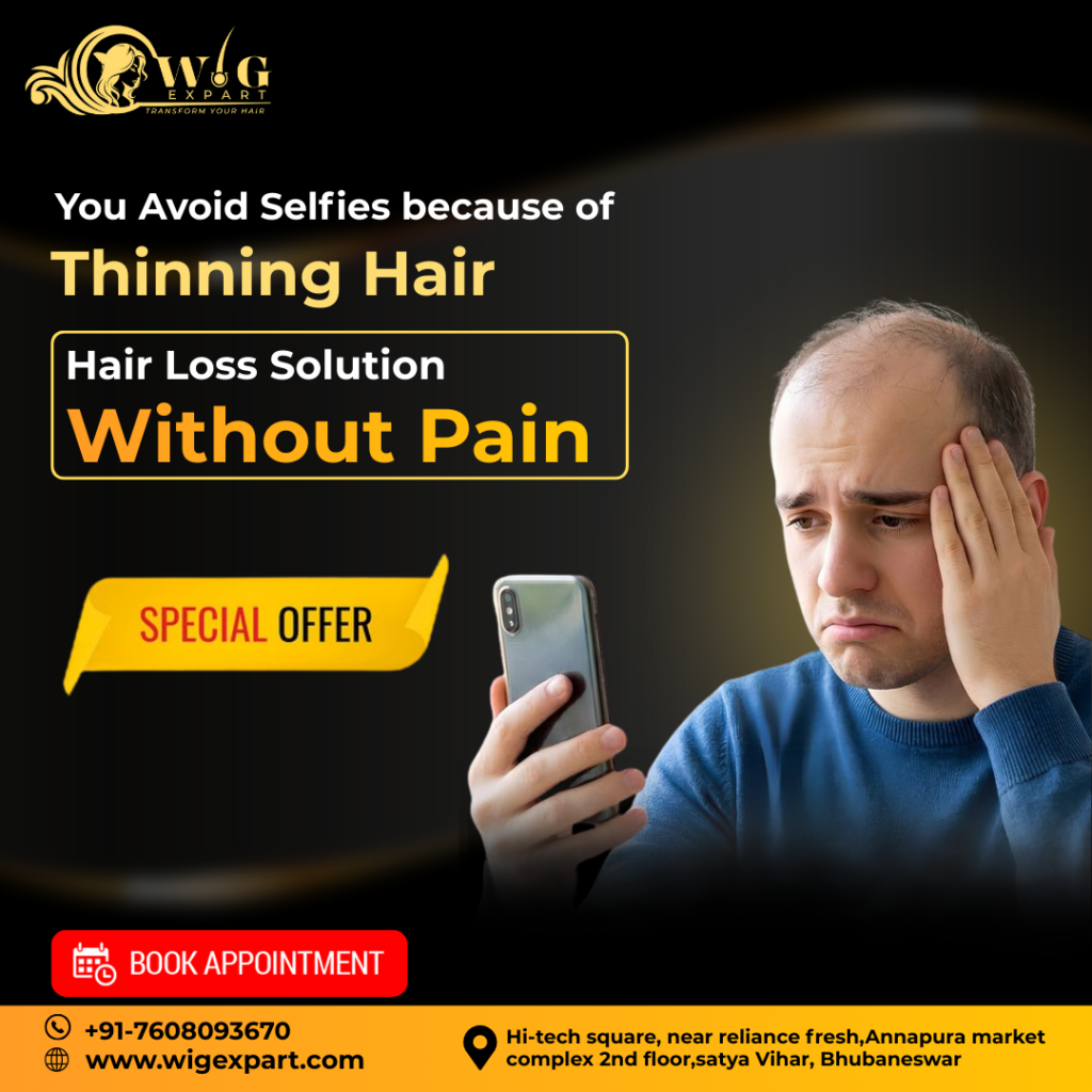 Hair Loss Solution Without Pain