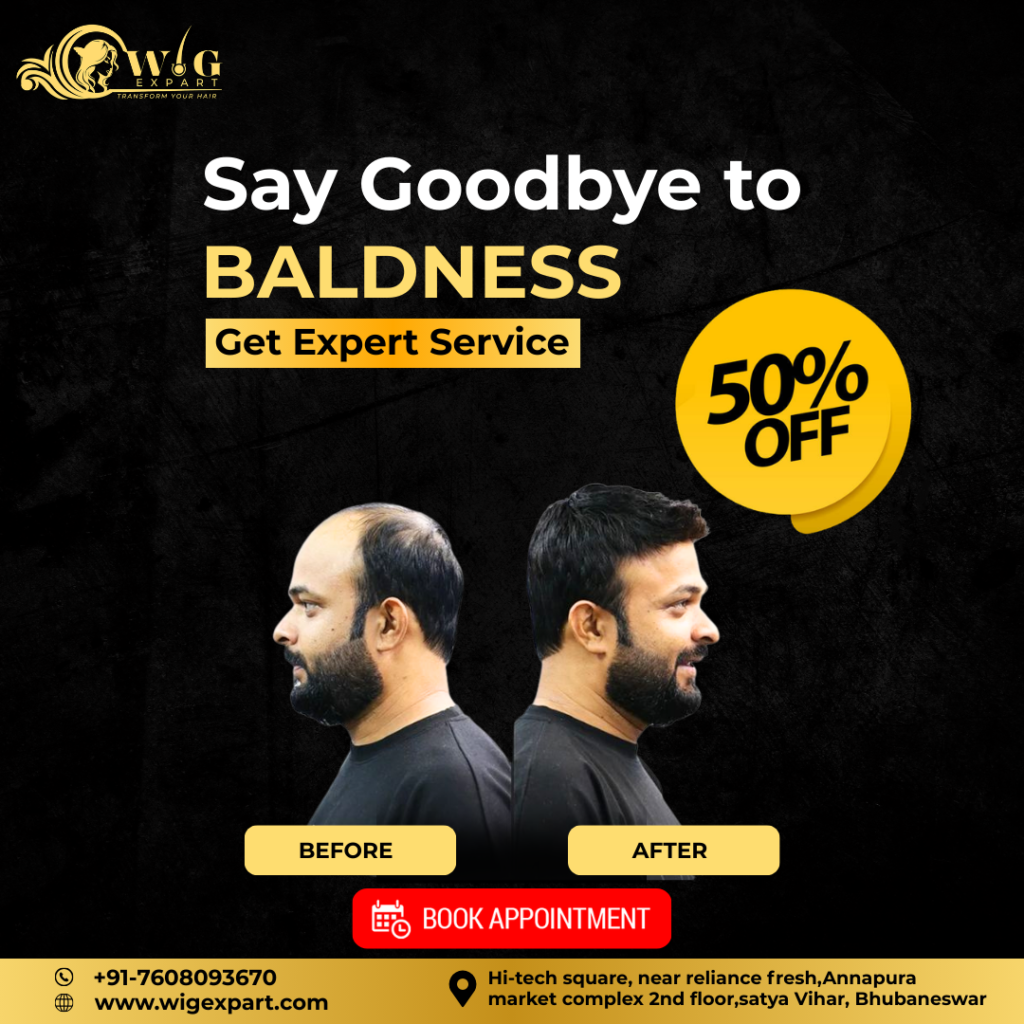 Say Goodbye to Baldness