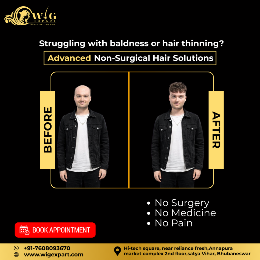 Struggling with baldness or hair thinning