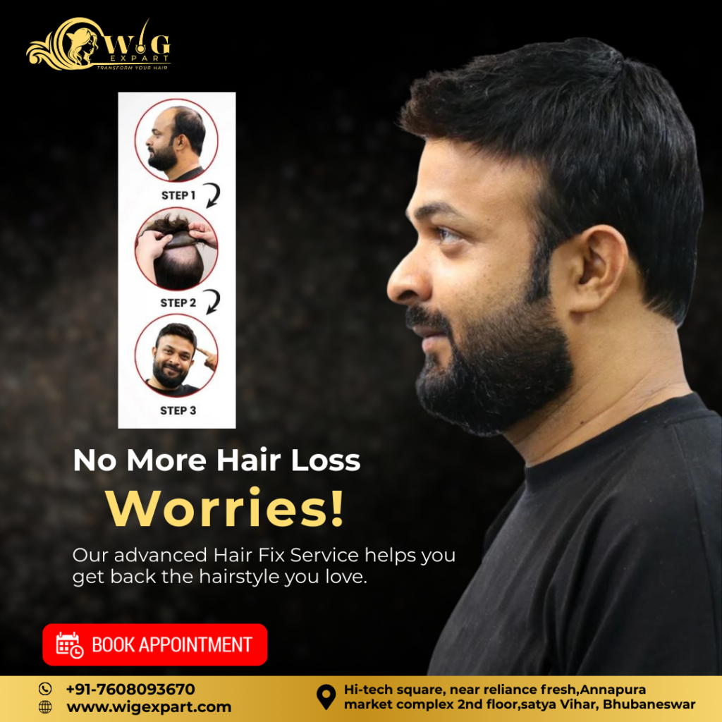 No More Hair Loss Worries!