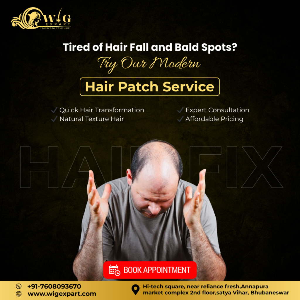 Tired of Hair Fall and Bald Spots